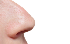 Dime que nariz tienes y te diré qué tipo de rinoplastia necesitas - Dr ...